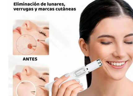 Pluma Laser Luz Azul Cuidado Facial Anti Acné Y Cicatrices