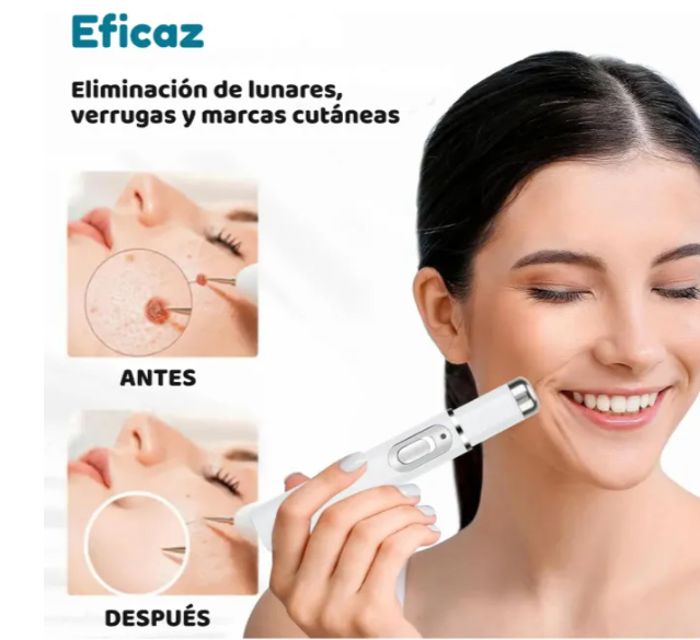 Pluma Laser Luz Azul Cuidado Facial Anti Acné Y Cicatrices